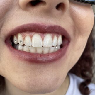 Tooth Gems - 3 crystals